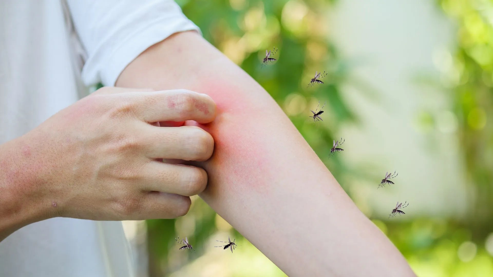 Home Remedies: Natural Itch Relief for Healing Mosquito Bites